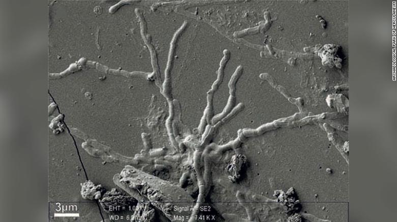 Итальянские ученые нашли часть мозга человека, который погиб во время древнего извержения Везувия