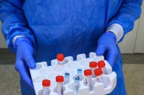 Ученые нашли коронавирус в анализах, взятых в Италии в сентябре 2019 года