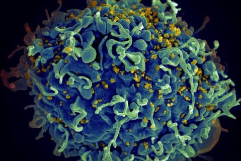 В Японии изобрели вакцину от ВИЧ и испытали ее на обезьянах