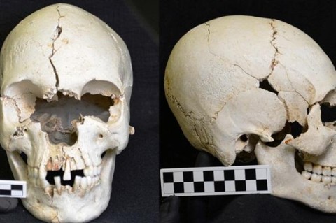 На Карибах нашли 200-летний череп больного проказой человека